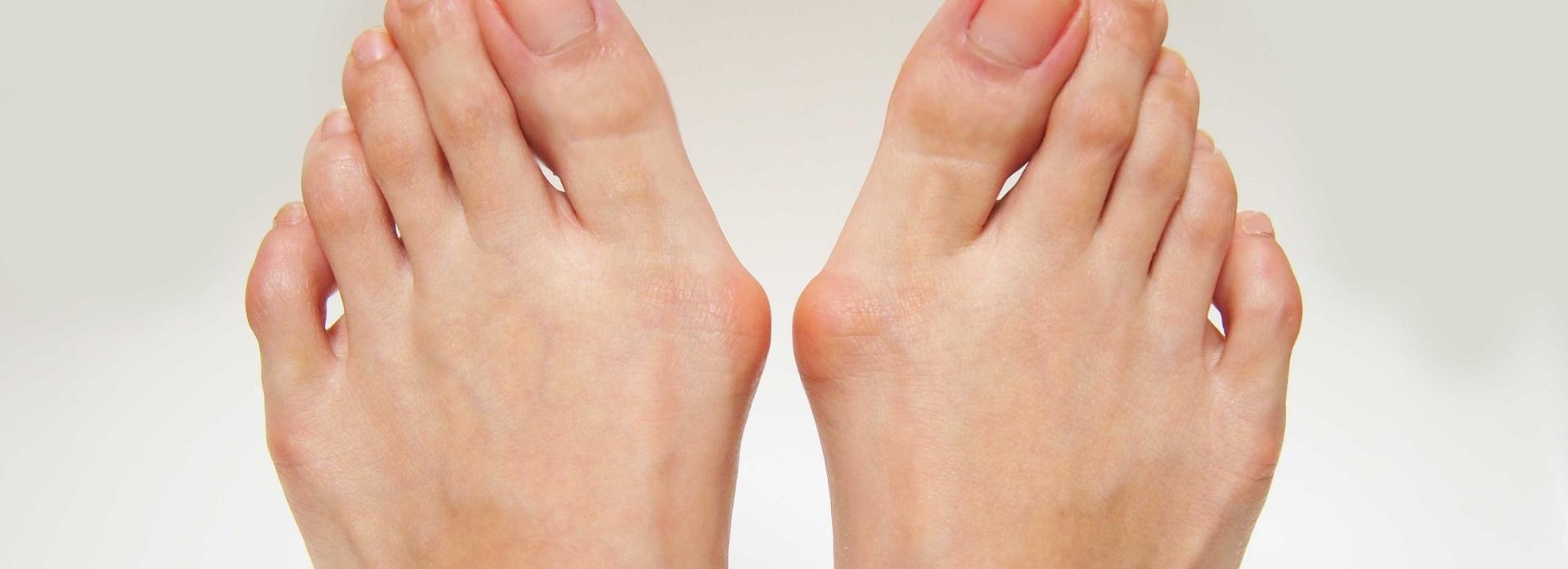 Iatrogenic Hallux Varus