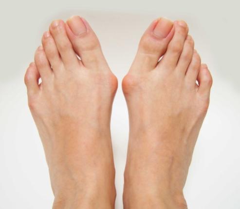 Iatrogenic Hallux Varus